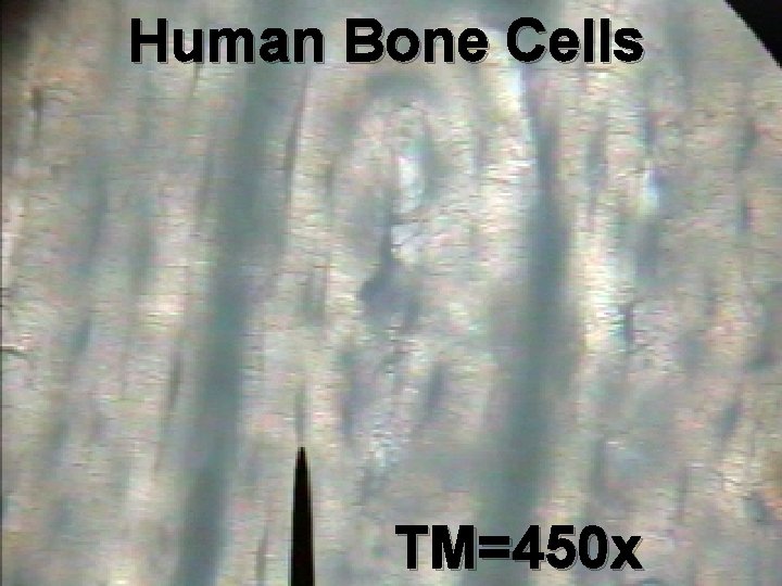 Human Bone Cells TM=450 x 