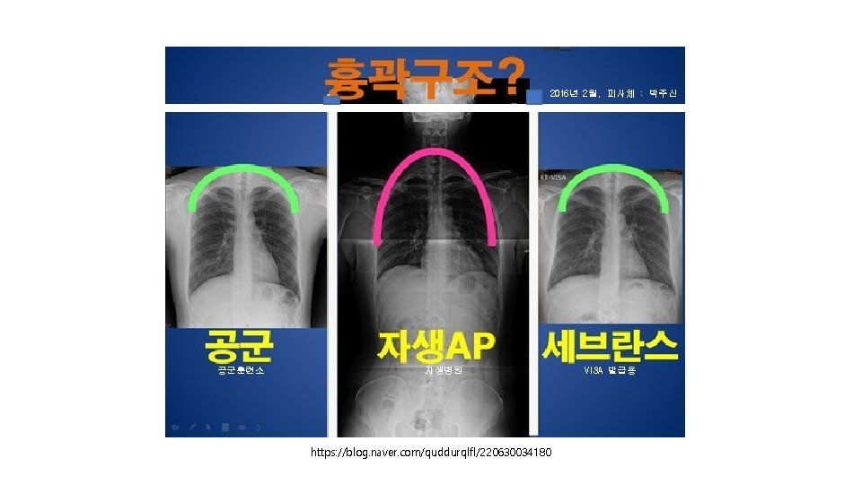 2016년 2월, 피사체 : 박주신 공군훈련소 자생병원 https: //blog. naver. com/quddurqlfl/220630034180 VISA 발급용 