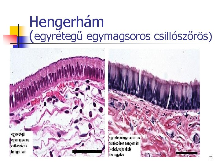 Hengerhám (egyrétegű egymagsoros csillószőrös) 21 