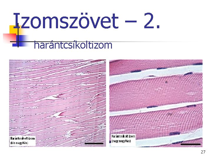 Izomszövet – 2. harántcsíkoltizom 27 