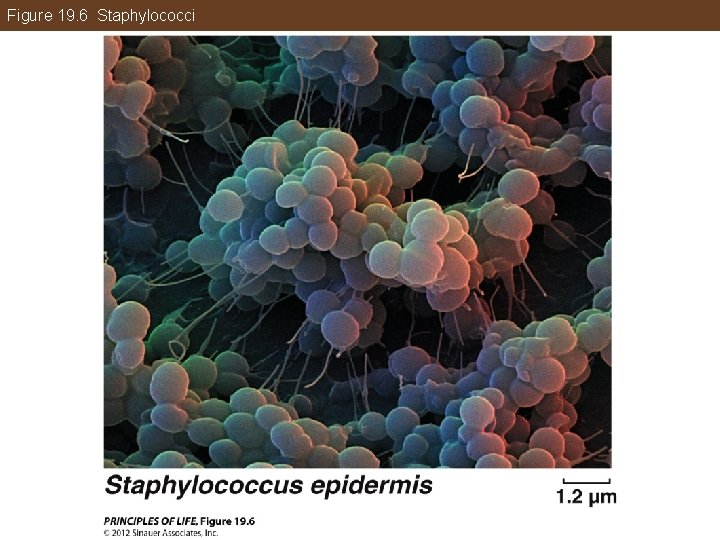 Figure 19. 6 Staphylococci 