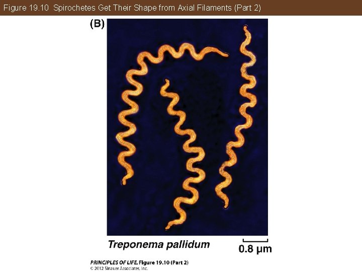 Figure 19. 10 Spirochetes Get Their Shape from Axial Filaments (Part 2) 