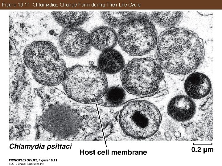 Figure 19. 11 Chlamydias Change Form during Their Life Cycle 