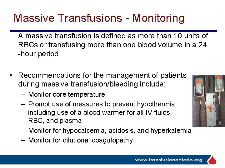 Massive Transfusions - Monitoring A massive transfusion is defined as more than 10 units
