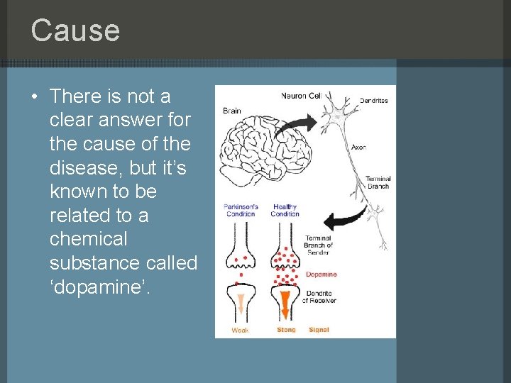 Cause • There is not a clear answer for the cause of the disease,