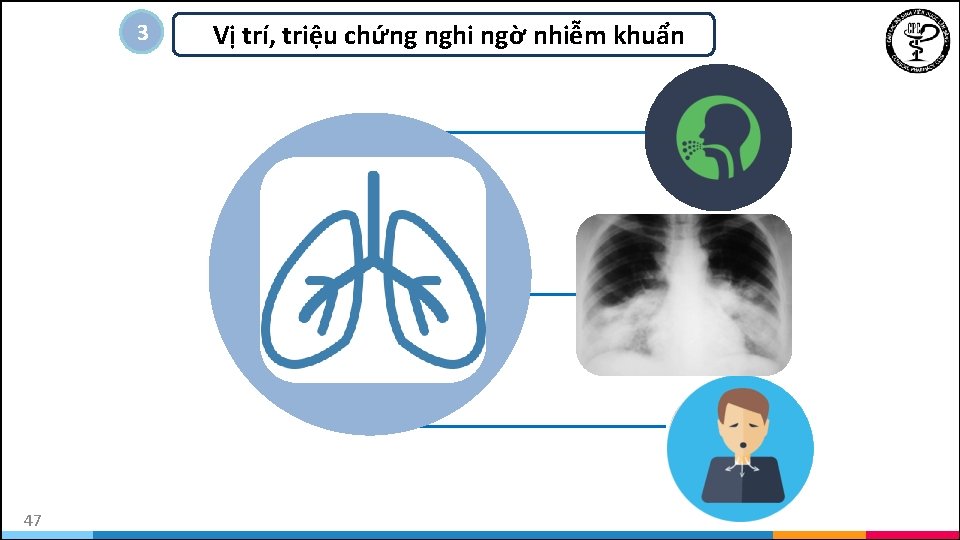 33 47 Vị trí, triệu chứng nghi ngờ nhiễm khuẩn 