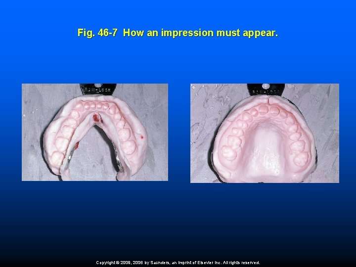 Fig. 46 -7 How an impression must appear. Copyright © 2009, 2006 by Saunders,