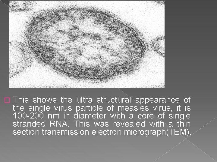 � This shows the ultra structural appearance of the single virus particle of measles