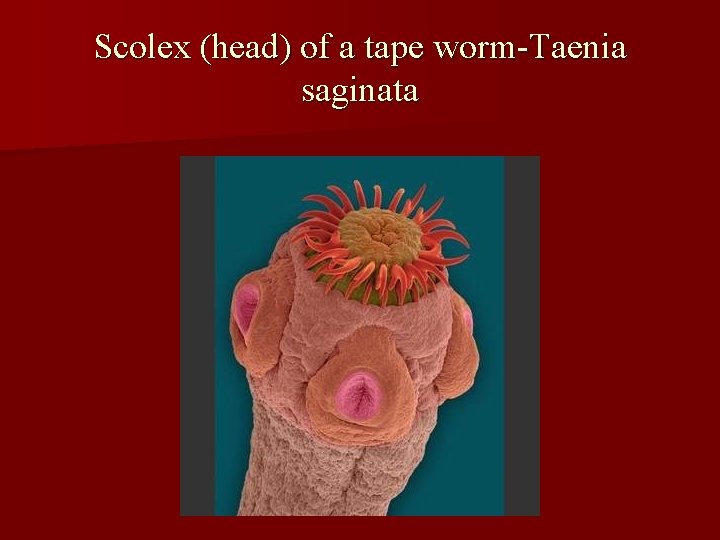 Scolex (head) of a tape worm-Taenia saginata 