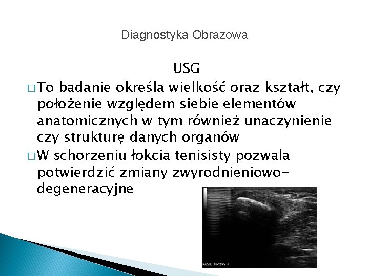 Diagnostyka Obrazowa USG � To badanie określa wielkość oraz kształt, czy położenie względem siebie