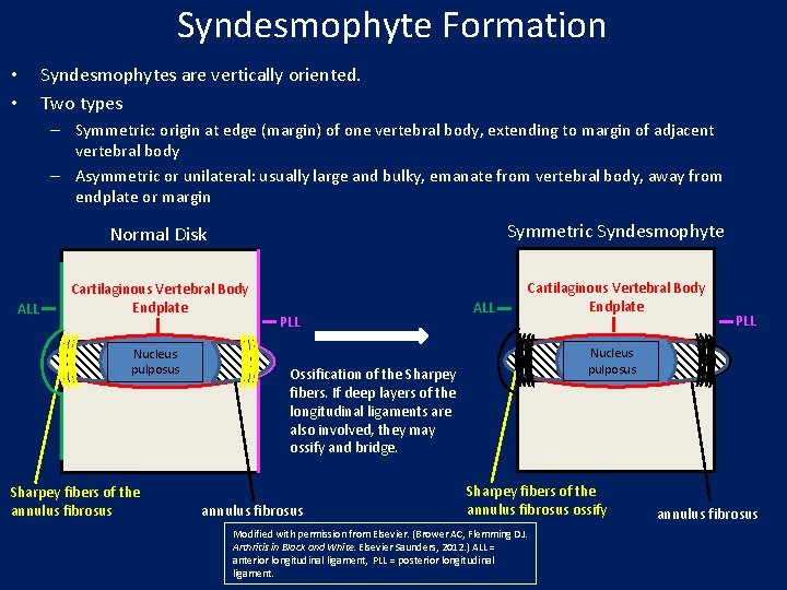 Syndesmophyte Formation • • Syndesmophytes are vertically oriented. Two types – Symmetric: origin at