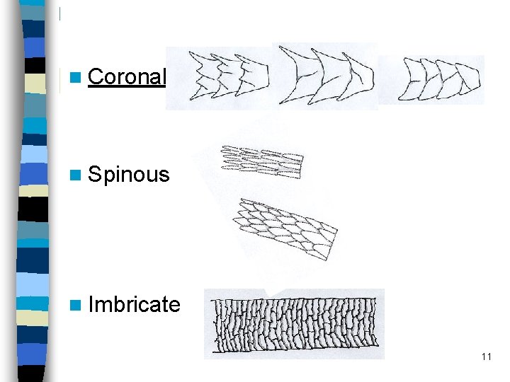 n Coronal n Spinous n Imbricate 11 