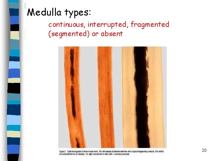 Medulla types: continuous, interrupted, fragmented (segmented) or absent 20 