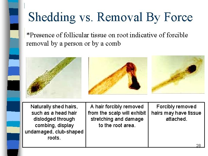Shedding vs. Removal By Force *Presence of follicular tissue on root indicative of forcible