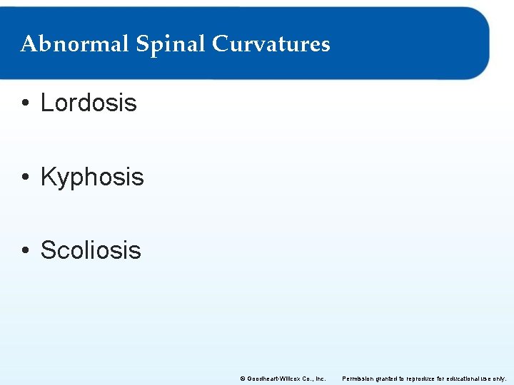 Abnormal Spinal Curvatures • Lordosis • Kyphosis • Scoliosis © Goodheart-Willcox Co. , Inc. Abnormal Spinal Curvatures • Lordosis • Kyphosis • Scoliosis © Goodheart-Willcox Co. , Inc.