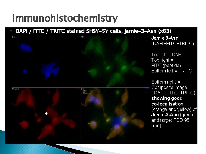 Immunohistochemistry DAPI / FITC / TRITC stained SHSY-5 Y cells, Jamie-3 -Asn (x 63)