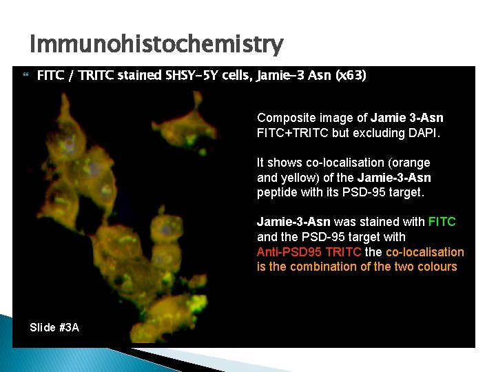 Immunohistochemistry FITC / TRITC stained SHSY-5 Y cells, Jamie-3 Asn (x 63) Composite image