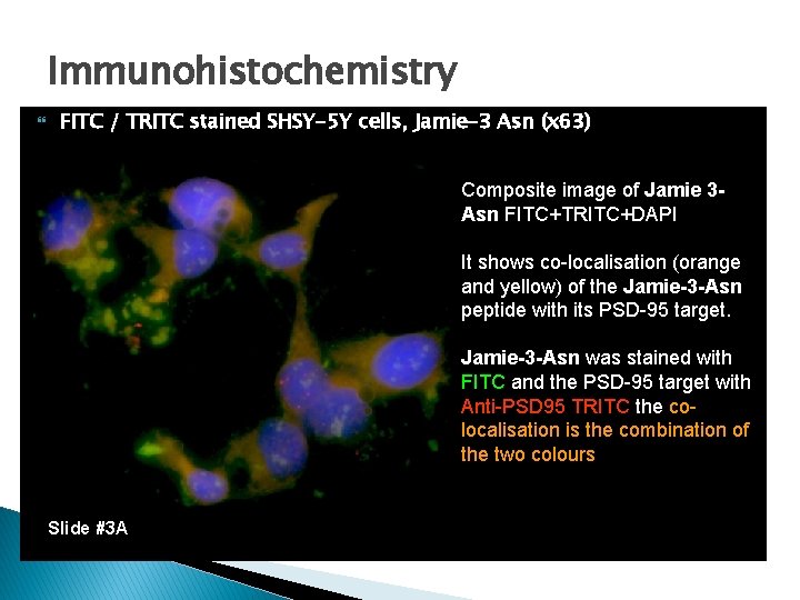 Immunohistochemistry FITC / TRITC stained SHSY-5 Y cells, Jamie-3 Asn (x 63) Composite image