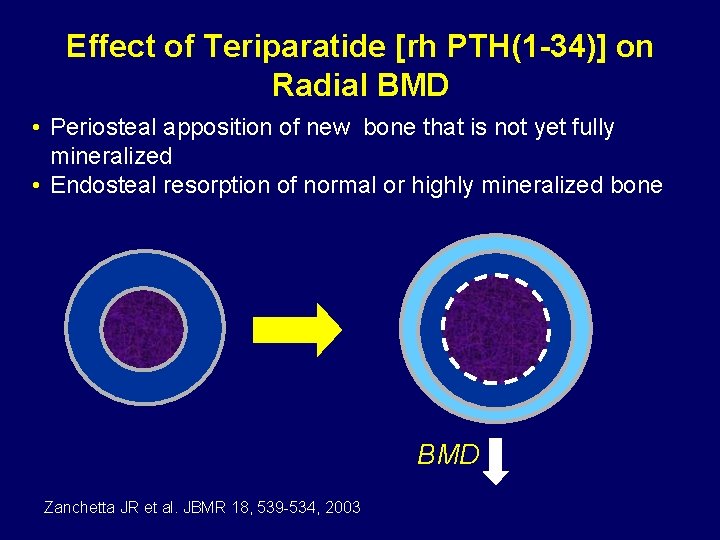 Effect of Teriparatide [rh PTH(1 -34)] on Radial BMD • Periosteal apposition of new