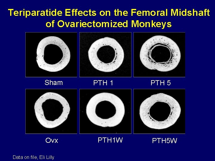 Teriparatide Effects on the Femoral Midshaft of Ovariectomized Monkeys Sham Ovx Data on file,