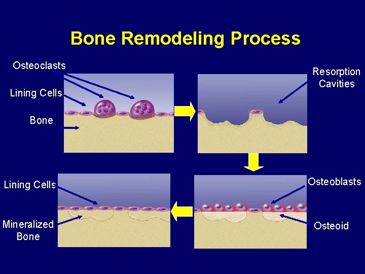 Bone Remodeling Process Osteoclasts Lining Cells Resorption Cavities Bone Lining Cells Mineralized Bone Osteoblasts