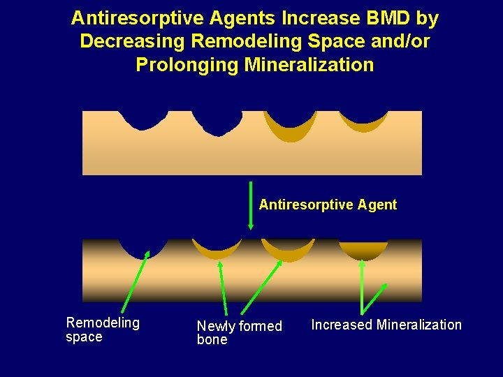 Antiresorptive Agents Increase BMD by Decreasing Remodeling Space and/or Prolonging Mineralization Antiresorptive Agent Remodeling
