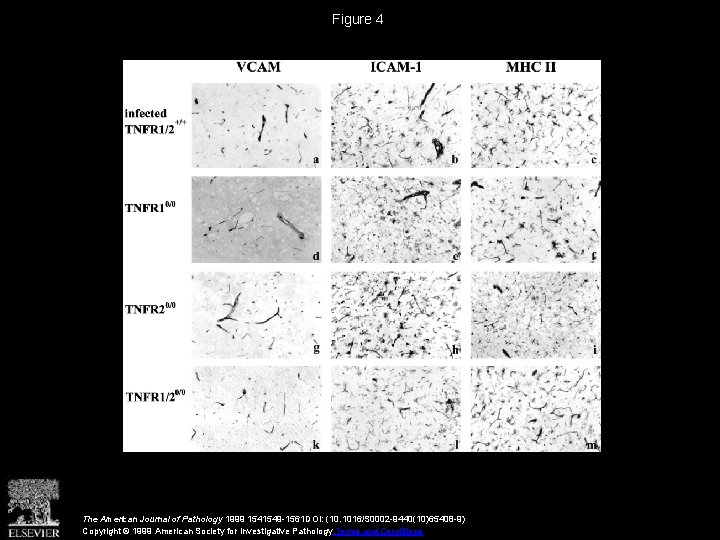 Figure 4 The American Journal of Pathology 1999 1541549 -1561 DOI: (10. 1016/S 0002
