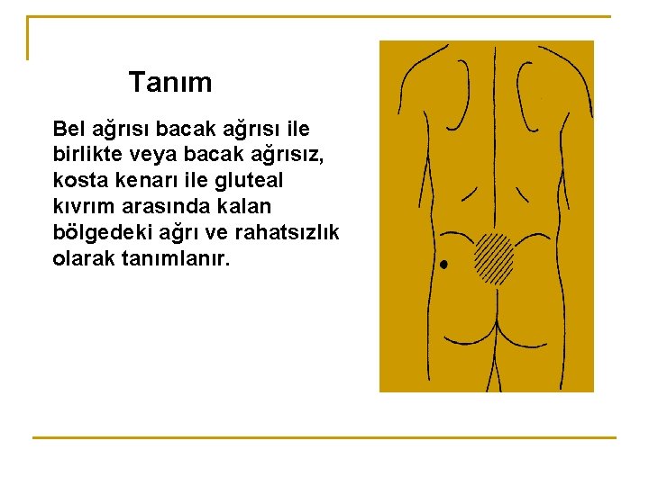 Tanım Bel ağrısı bacak ağrısı ile birlikte veya bacak ağrısız, kosta kenarı ile gluteal