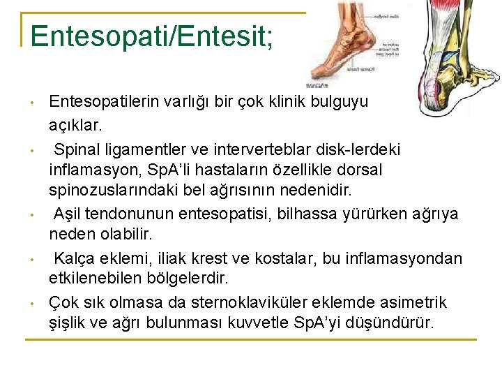 Entesopati/Entesit; • • • Entesopatilerin varlığı bir çok klinik bulguyu açıklar. Spinal ligamentler ve