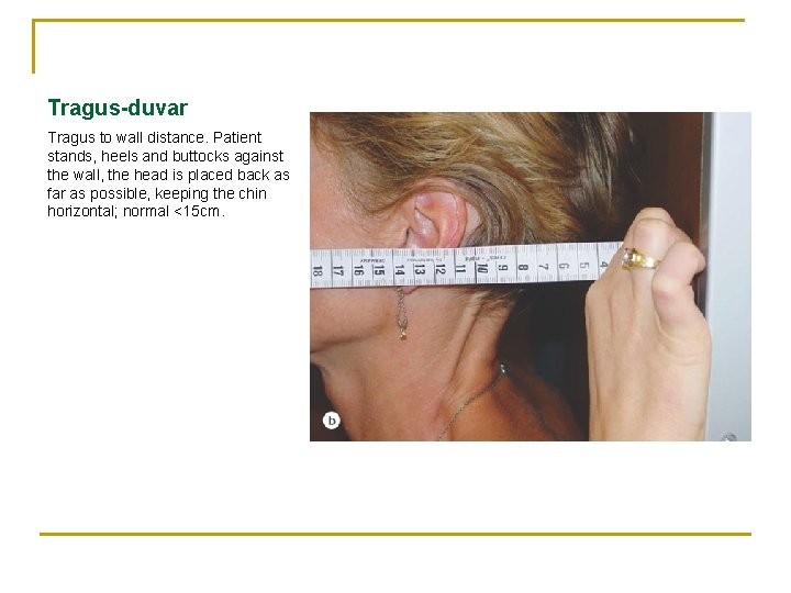 Tragus-duvar Tragus to wall distance. Patient stands, heels and buttocks against the wall, the