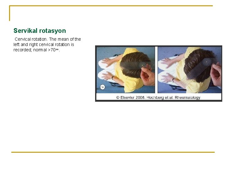 Servikal rotasyon Cervical rotation. The mean of the left and right cervical rotation is