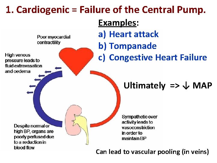 1. Cardiogenic = Failure of the Central Pump. Examples: a) Heart attack b) Tompanade