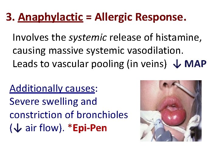 3. Anaphylactic = Allergic Response. Involves the systemic release of histamine, causing massive systemic
