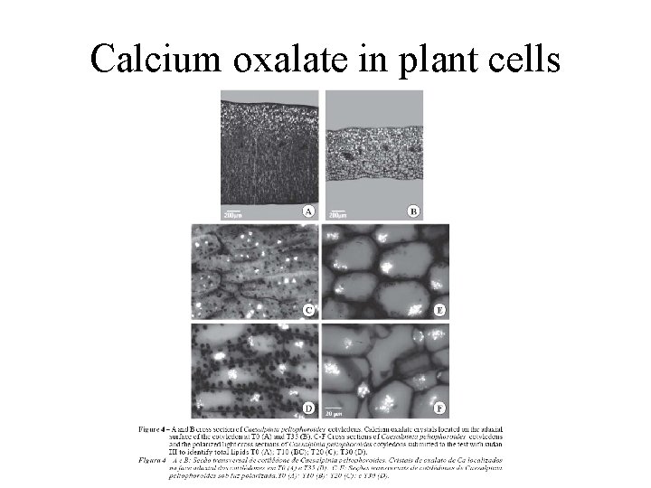 Calcium oxalate in plant cells 