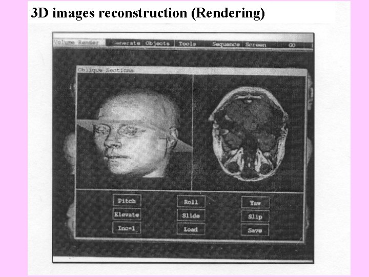 3 D images reconstruction (Rendering) 