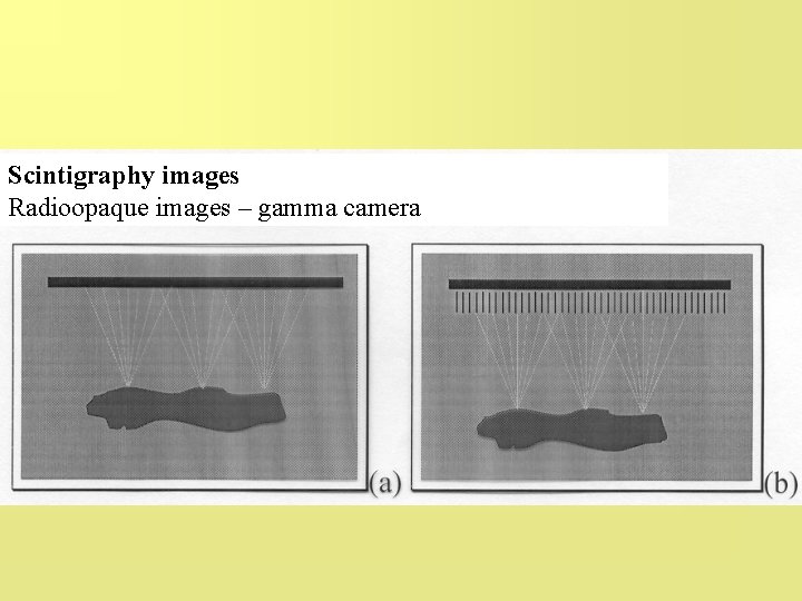 Scintigraphy images Radioopaque images – gamma camera 