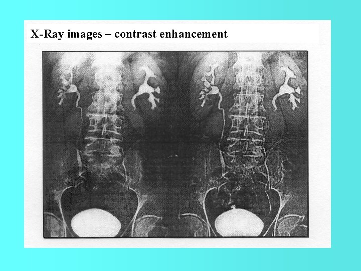 X-Ray images – contrast enhancement 