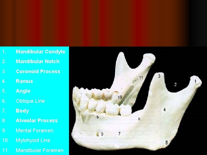 1. Mandibular Condyle 2. Mandibular Notch 3. Coronoid Process 4. Ramus 5. Angle 6.