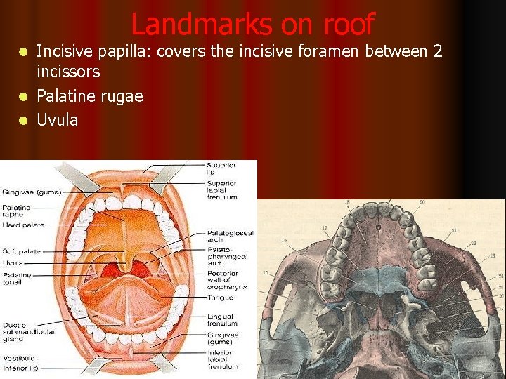 Landmarks on roof Incisive papilla: covers the incisive foramen between 2 incissors l Palatine