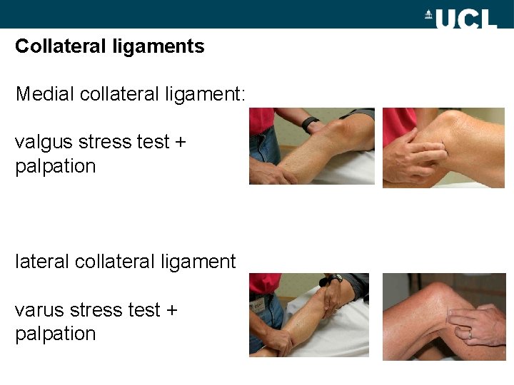 Collateral ligaments Medial collateral ligament: valgus stress test + palpation lateral collateral ligament varus