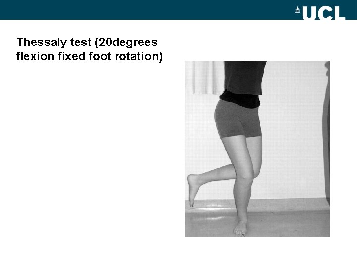 Thessaly test (20 degrees flexion fixed foot rotation) 