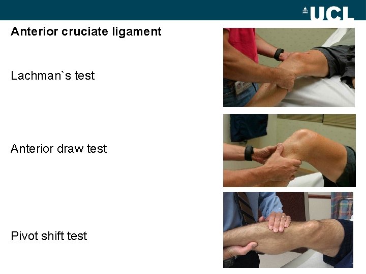 Anterior cruciate ligament Lachman`s test Anterior draw test Pivot shift test 