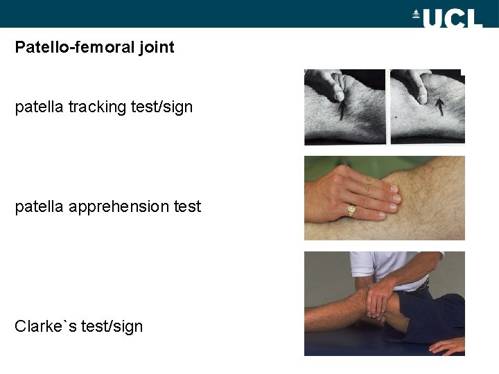 Patello-femoral joint patella tracking test/sign patella apprehension test Clarke`s test/sign 