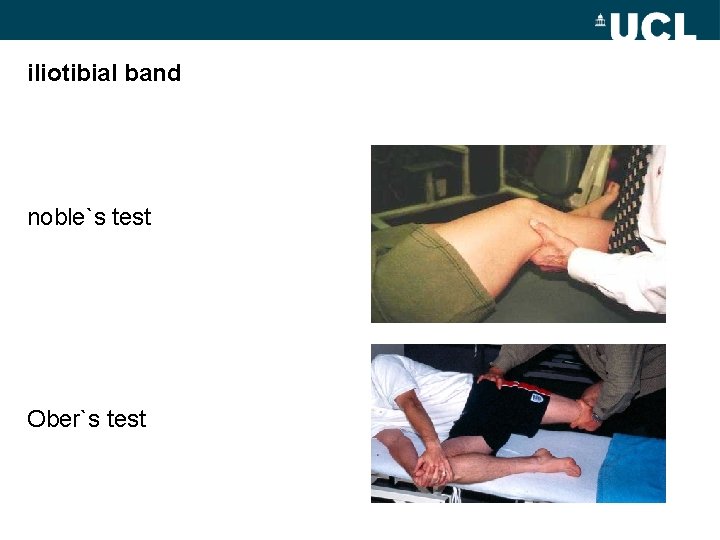 iliotibial band noble`s test Ober`s test 