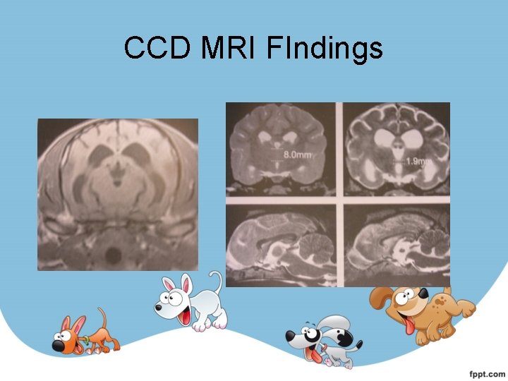 CCD MRI FIndings 