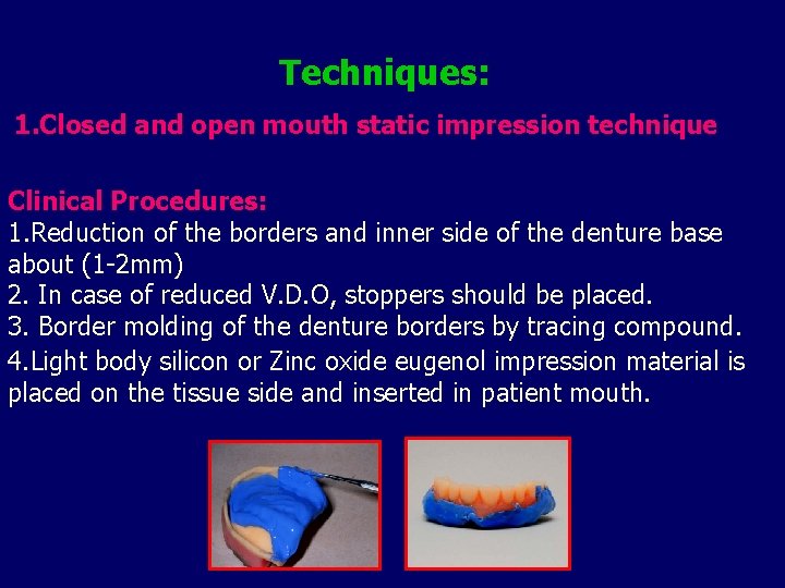Techniques: 1. Closed and open mouth static impression technique Clinical Procedures: 1. Reduction of