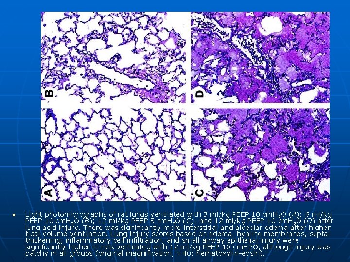 n Light photomicrographs of rat lungs ventilated with 3 ml/kg PEEP 10 cm. H