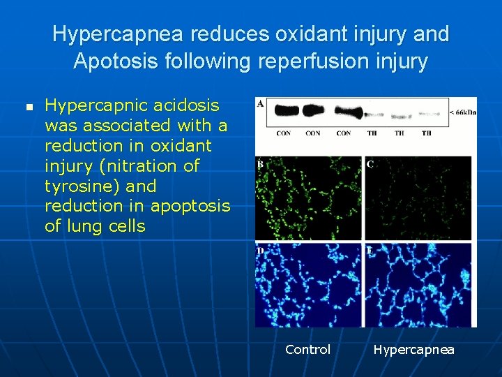 Hypercapnea reduces oxidant injury and Apotosis following reperfusion injury n Hypercapnic acidosis was associated