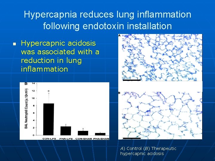 Hypercapnia reduces lung inflammation following endotoxin installation n Hypercapnic acidosis was associated with a