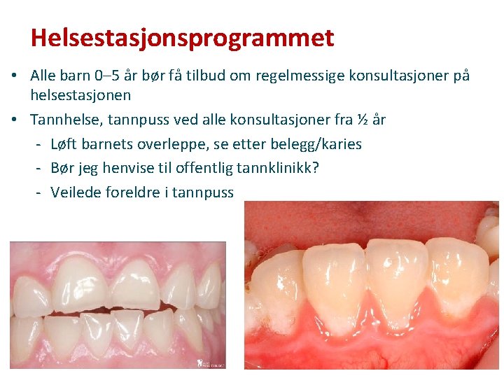 Helsestasjonsprogrammet • Alle barn 0– 5 år bør få tilbud om regelmessige konsultasjoner på